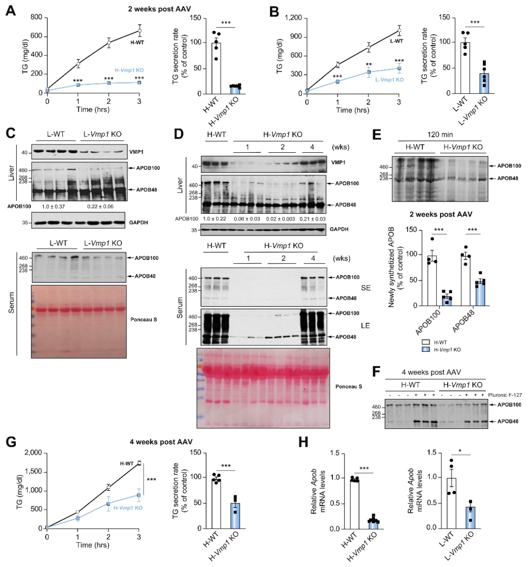 非酒精性脂肪性肝病患者脂肪变性的确切机制