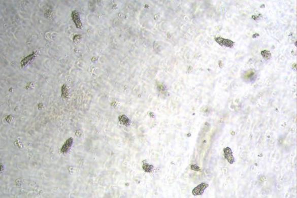 肠道类器官应用于治疗Dextran Sulfate Sodium Salt（DSS）诱导的溃疡性结肠炎