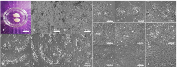 细胞学堂 | 微血管内皮细胞知识盘点