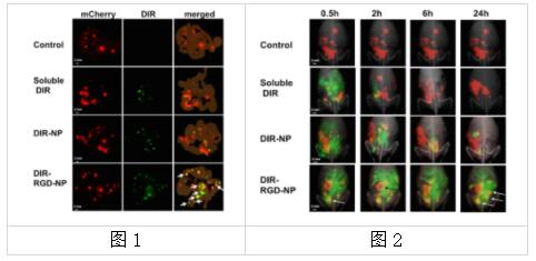 实例展示丨艾美捷细胞膜荧光探针DiR研究 实例展示丨艾美捷细胞膜荧光探针DiR研究