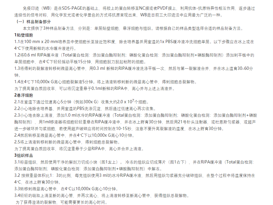 WB实验方法（从样品到结果）