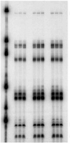 核糖核酸酶保护实验