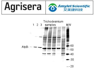 艾美捷 Agrisera丨AtpB | 阳性对照/定量标准 艾美捷 Agrisera丨AtpB | 阳性对照/定量标准