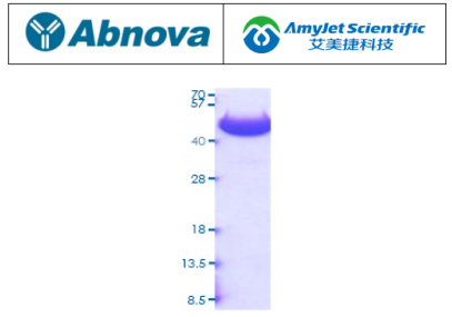 Abnova 艾美捷Acpp（小鼠）重组蛋白说明书