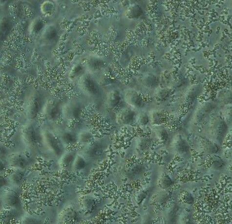 细胞污染的分类及注意事项