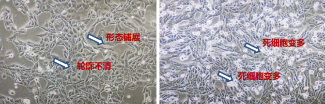 干货分享 | 给您一双鉴别支原体污染的慧眼