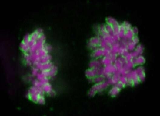 如何从细胞核中移除不想要的组分