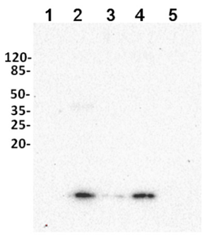 UBQ11|泛素(亲和纯化) 促销大促！实验室必备！