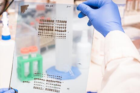 Jackson丨选择合适的亲和纯化二级抗体之考虑补充免疫试剂