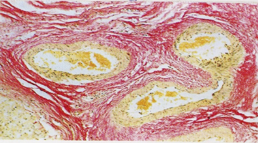 【实验方法】病理染色之Van Gieson染色实验