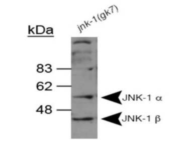 JNK1抗体的应用及工作稀释液参考 JNK1抗体的应用及工作稀释液参考