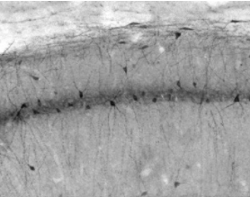NeuroMab高特异性抗Slo2.2/Slack K+通道抗体(N3/26)促销 NeuroMab高特异性抗Slo2.2/Slack K+通道抗体(N3/26)促销