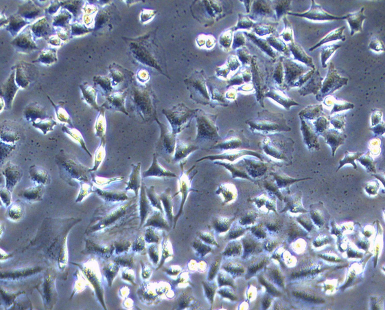 细胞支原体污染之一般情况