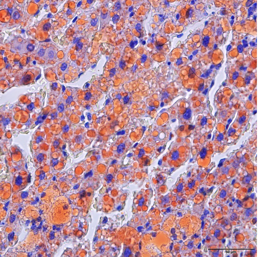 新品早知道|改良油红O染色试剂盒（环保型）