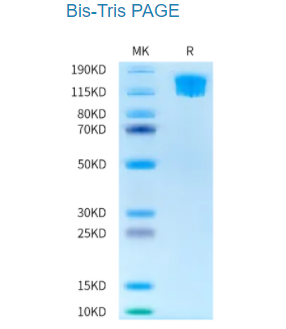 生物素化人类SEZ6L2蛋白，优惠不容错过！