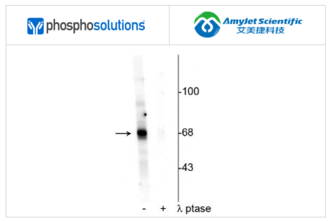艾美捷Phosphosolutions抗AKT(Thr342)抗体方案 艾美捷Phosphosolutions抗AKT(Thr342)抗体方案