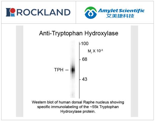 Rockland色氨酸羟化酶抗体丨羊多克隆