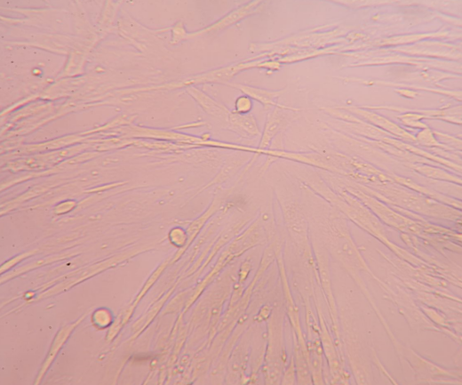 关节炎CIA (5).png