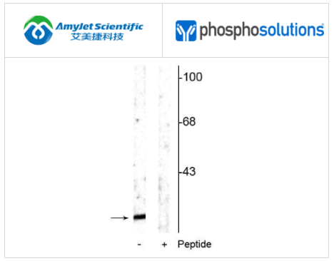PhosphoSolutions抗α突触核蛋白（Ser129）抗体解决方案   
