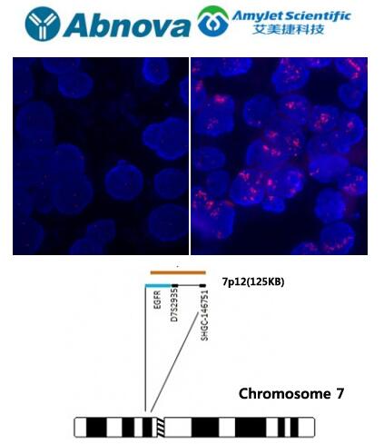 Abnova丨艾美捷EGFR FISH 探针解决方案 Abnova丨艾美捷EGFR FISH 探针解决方案