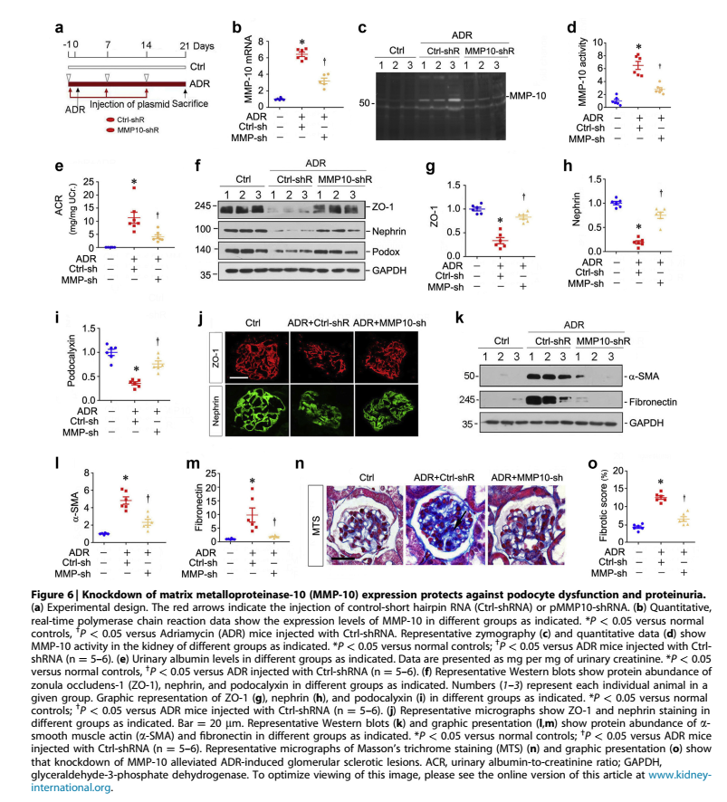 MMP10加重ADR模型足细胞损伤 