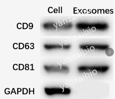 外泌体WB检测.png 外泌体WB检测.png