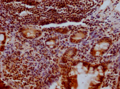 Epigentek-KLF4重组单克隆抗体[3A1]开启超值抢购季