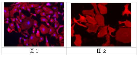 中英文说明丨艾美捷细胞膜荧光探针DiR相关介绍 中英文说明丨艾美捷细胞膜荧光探针DiR相关介绍
