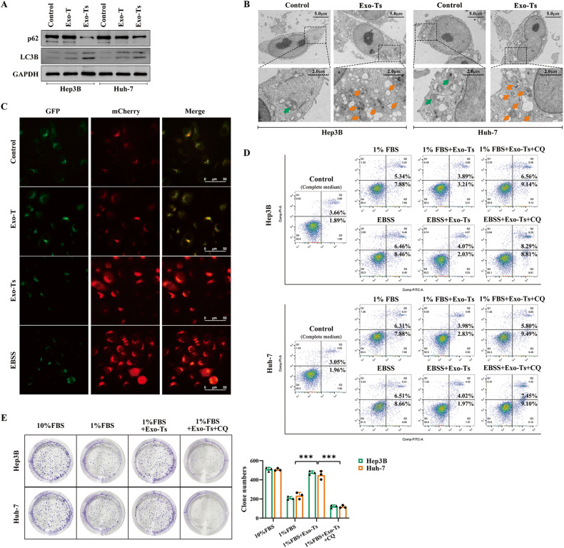 外泌体和细胞自噬