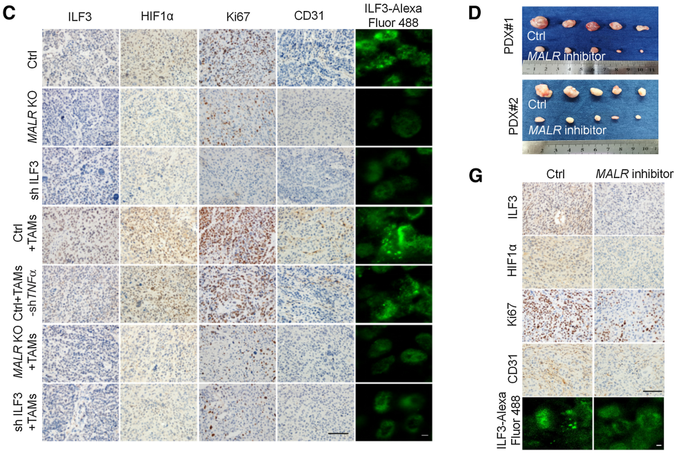 【客户文献解读,IF>11】食管癌的