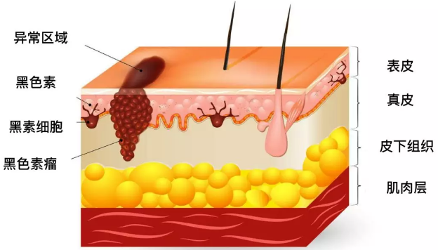 多色文献分享：探究黑色素瘤的肿瘤免疫微环境