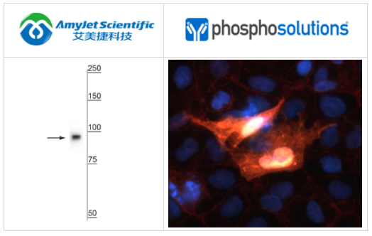 PhosphoSolutions抗β连环蛋白抗体实例展示 PhosphoSolutions抗β连环蛋白抗体实例展示