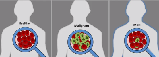 【药物研发应用6】微小残留病灶 MRD