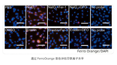 实验技巧 | 收藏铁死亡检测的关键指标，助力发表SCI文章