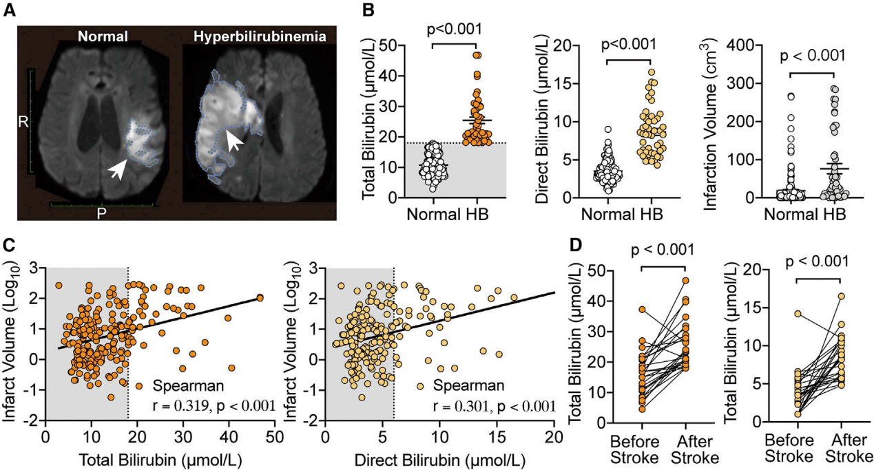 文献解析 | 胆红素作为直接激动剂阻断TRPM2通道加重缺血性脑损伤