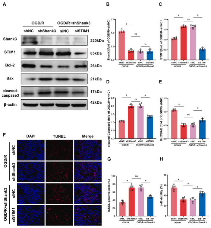 客户文献分享，IF＞11|Shank3：脑缺血再灌注损伤的守护者，揭示神经保护的新篇章