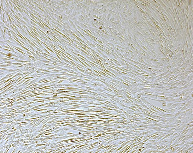 干货 | MSC细胞培养 “秘籍”