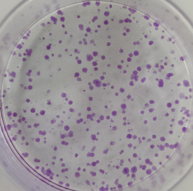 毫无保留，教你2种细胞集落形成实验