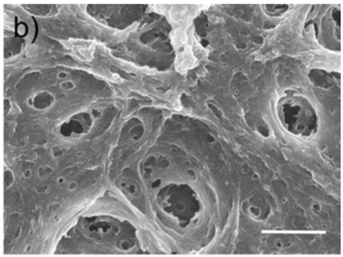 干货分享 | Transwell侵袭实验