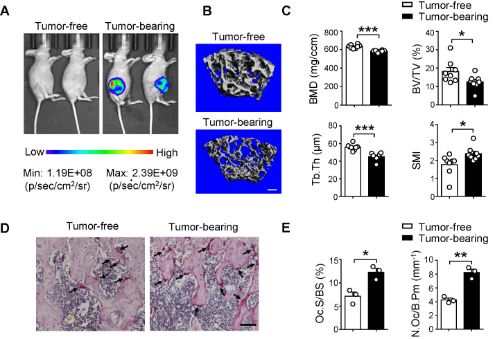 乳腺癌外泌体有助于转移前的生态位形成并促进肿瘤细胞的骨转移