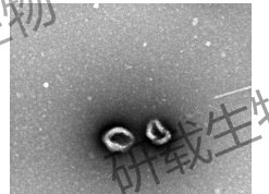外泌体透射电镜.png 外泌体透射电镜.png