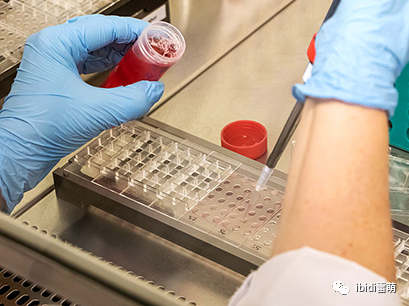 ibidi实验过程中的5关键问题是什么？ibidi细胞培养及成像样品制备解决方案详解