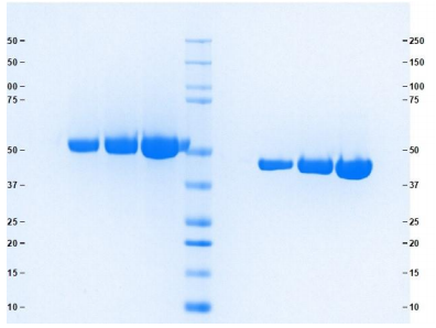 Athens-混合型GC球蛋白（维生素D结合蛋白），超值好物不容错过