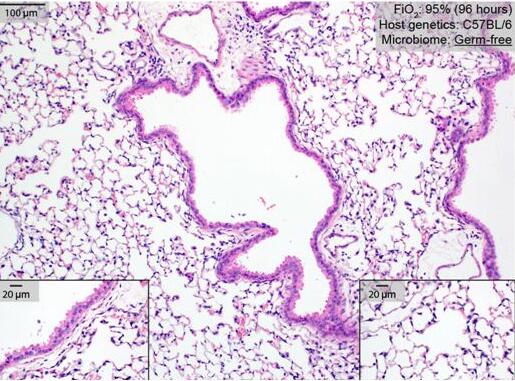 氧气水平的肺部中炎症和损伤方面发挥作用