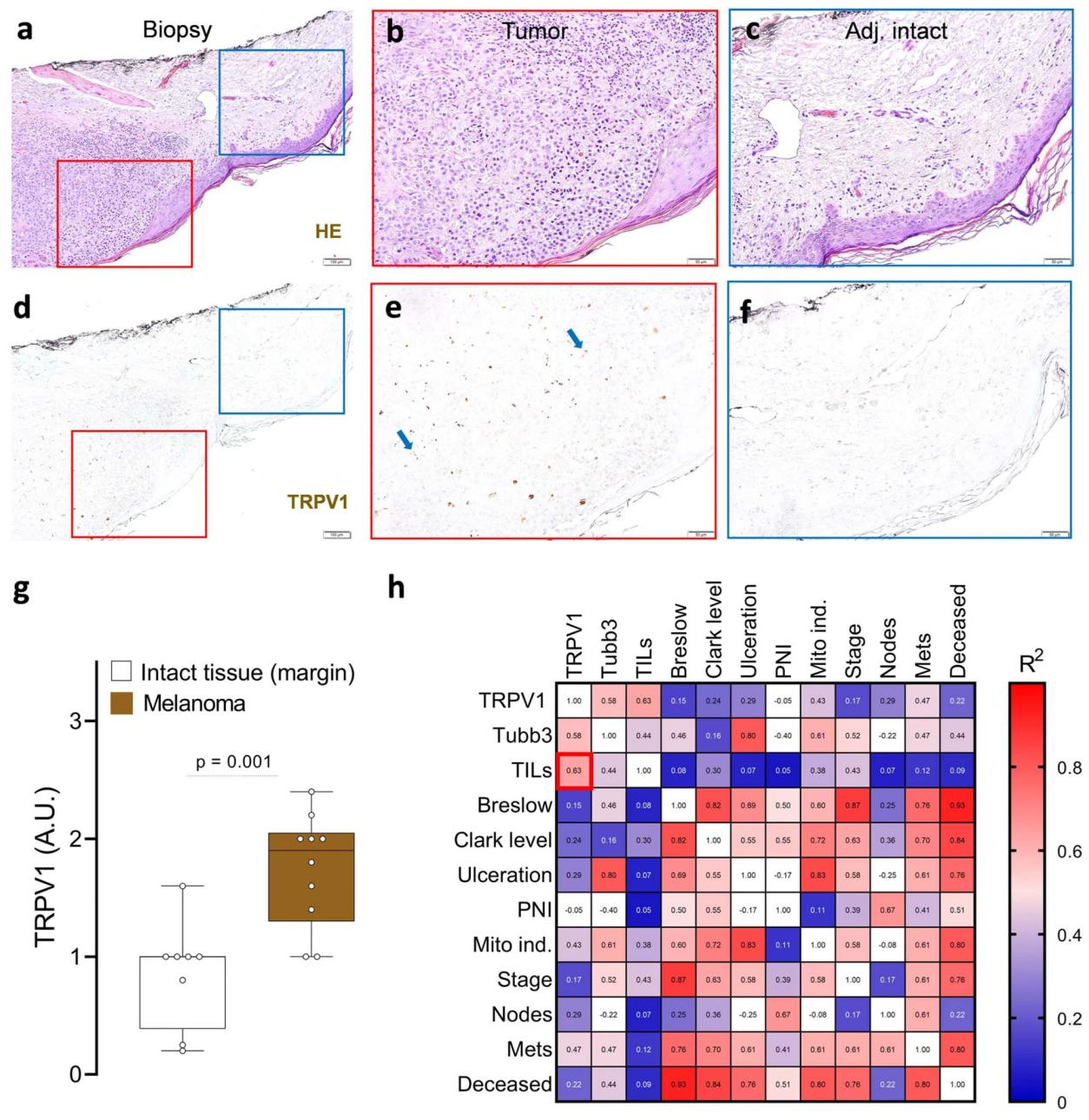 黑色素瘤-疼痛竟然还可以帮助癌症？