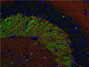 IHC-P： VGluT1(1:500; 红) 