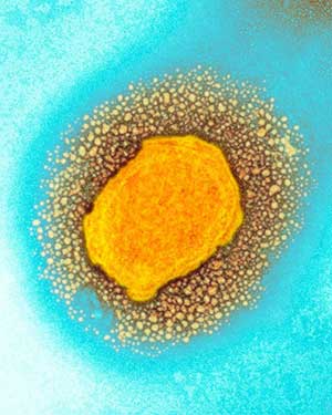 新冠未退，猴痘又起