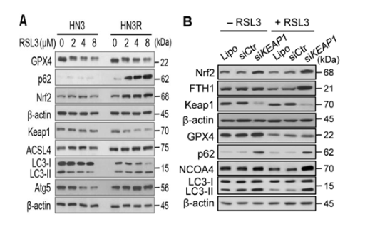 铁死亡相关蛋白表达检测.png 铁死亡相关蛋白表达检测.png