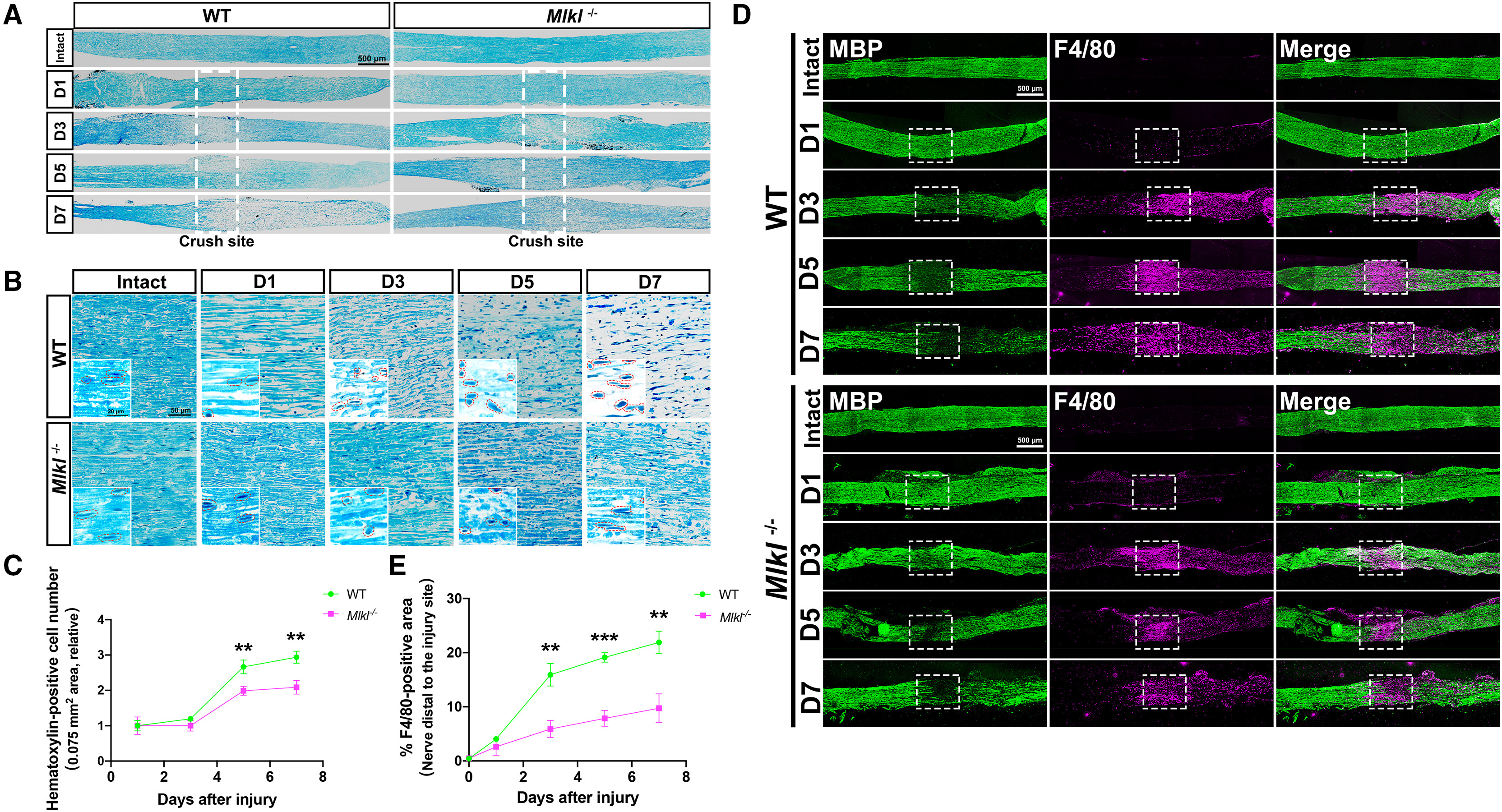 LabEx多因子检测助力神经研究，解密雪旺细胞促进巨噬细胞招募机制