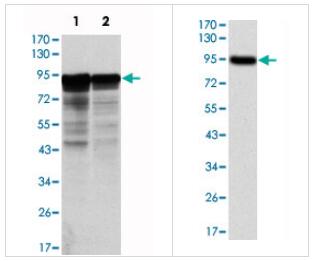 艾美捷NEFL单克隆抗体,克隆 1H3说明书 艾美捷NEFL单克隆抗体,克隆 1H3说明书